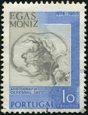 Portugal - 1974 - Centenario Nascimento Egas Moniz Angiografia Cerebral - 10Esc
