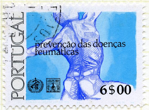 Portugal - 1977 - Ano Mundial Reumatismos - Prevencao Doencas Reumaticas - 6Esc