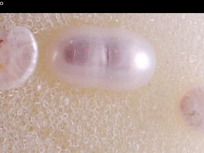 Perolas